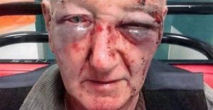 Elderly Farmers (80) Attacked - Paul Roux