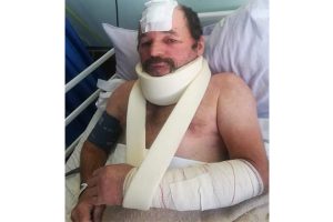 Are the police actually protecting and serving us? - Couple attacked by panga wielding intruder, police uninterested and hesitant to investigate incident